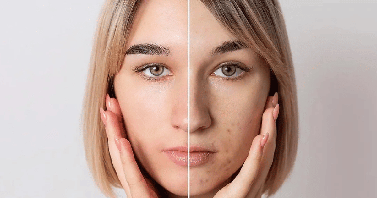 Semi di chia per la pelle: come usarli per aiutare a ridurre macchie scure e uniformare l’incarnato in modo naturale